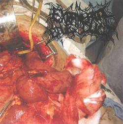 Extrahepatic Bile Duct : Extrahepatic Bile Duct